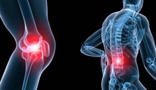 Osteoartroza